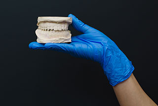 Image of casting of teeth