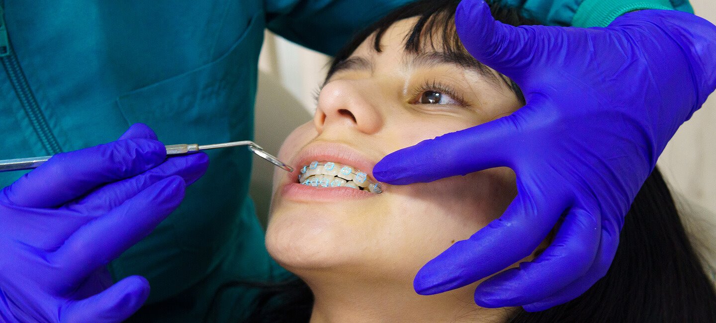Braces treatment - O'Brien Orthodontics: Englewood & Beavercreek Orthodontist