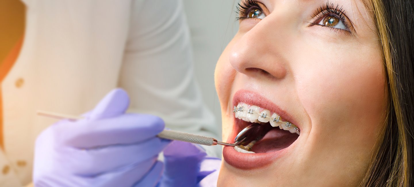 Dental treatment at O'Brien Orthodontics: Englewood & Beavercreek Orthodontist